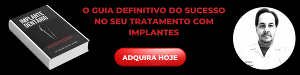 O-Guia-definitivo-do-sucesso-no-seu-tratamento-com-implantes-1 Quem Tem Osteoporose Pode Fazer Implante?